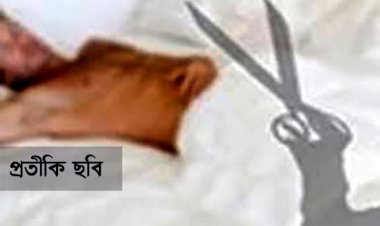 বাড়িতে ডেকে প্রেমিকের ‘বিশেষ অঙ্গ’ কাটলেন প্রেমিকা