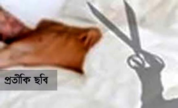 বাড়িতে ডেকে প্রেমিকের ‘বিশেষ অঙ্গ’ কাটলেন প্রেমিকা