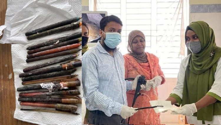 রোগীর পেট থেকে বের করা হলো ১৫ কলম!