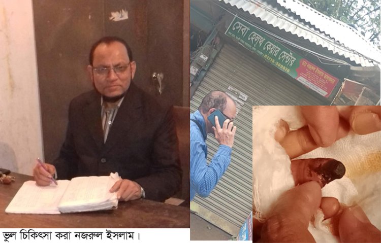 লালমোহনে ভুল চিকিৎসায় তিন বছরের শিশুর হাতের আঙ্গুল কর্তন